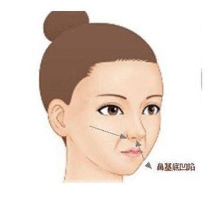 艾美莉艾美莉整形医生提问：你还在靠手部按摩祛法令纹吗?