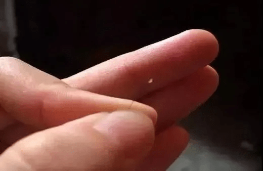 决定头发生死的毛囊真实面目竟然是这样脱发的进来看看吧