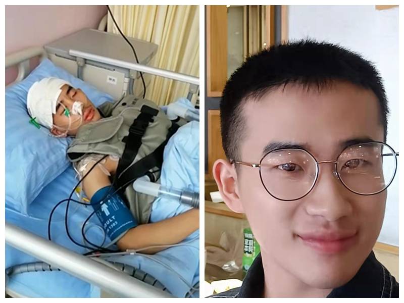 四川德阳19岁高三少年突发脑出血,相依为命的奶奶不能失去孙儿,恳请