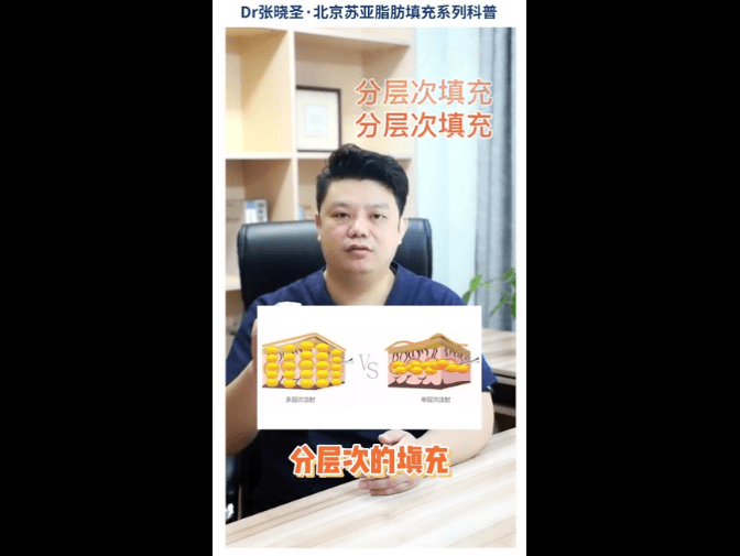 科普北京苏亚科普：脂肪填充苹果肌，法令纹会变重吗