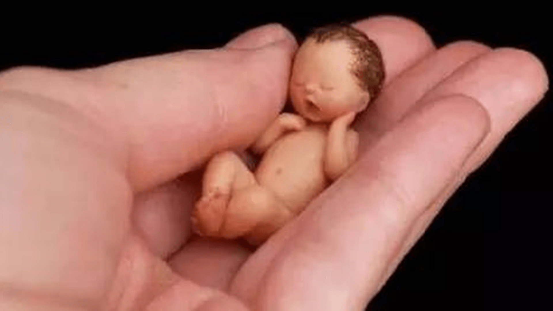 脾胃|7岁男童身高如同3岁孩童？脾胃衰竭，发育停滞