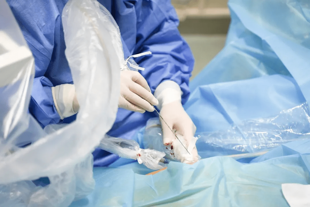 硬核纳秒刀万伏高压电瞬击癌细胞