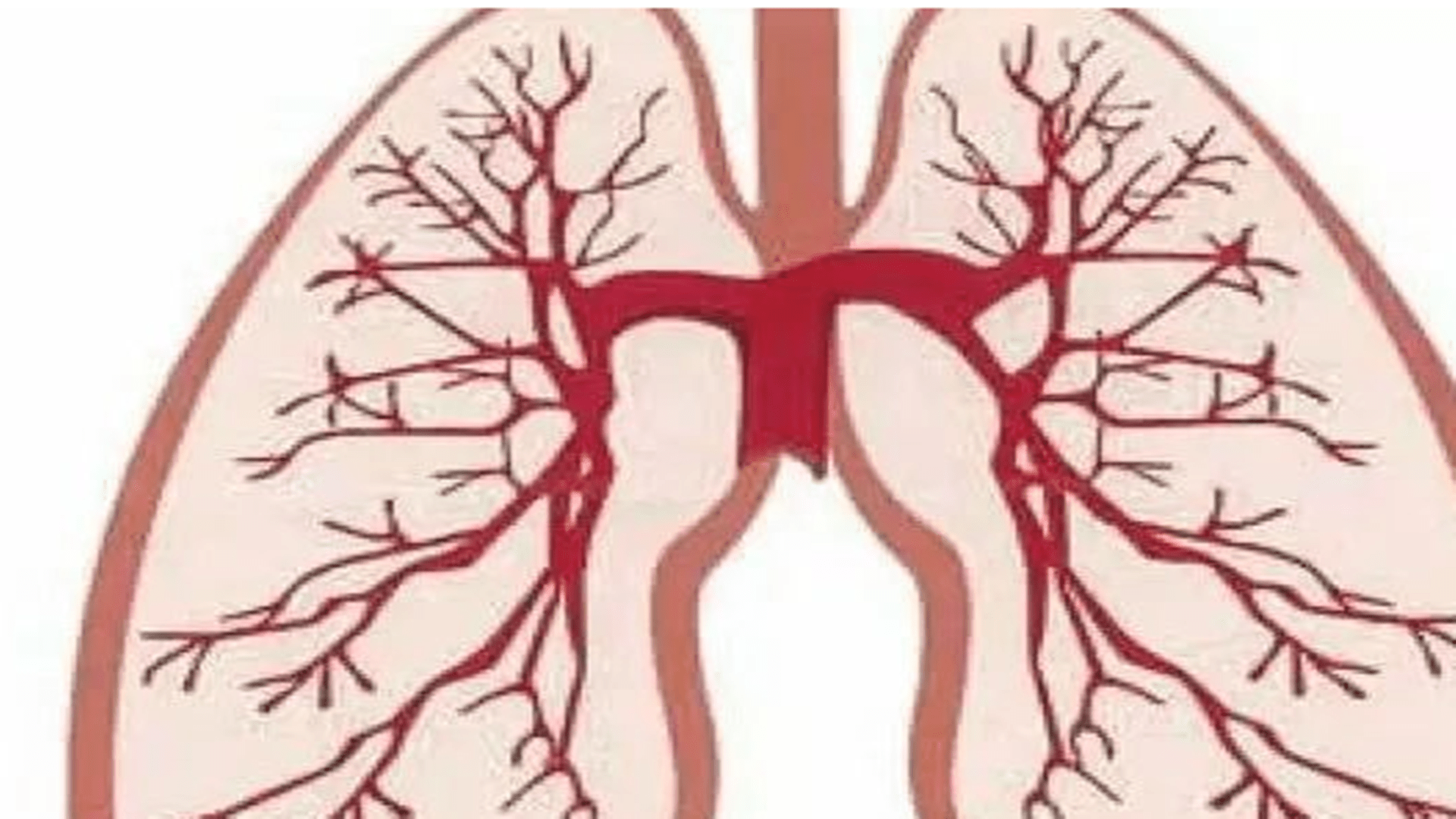 中草药|消炎药并非只有头孢，中成药里的“消炎药”，副作用更少