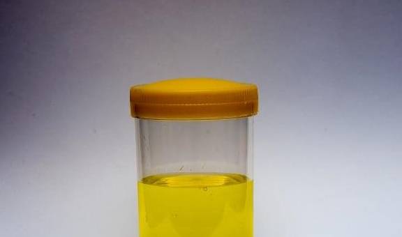 功能|排尿时发现这4个“蹊跷”,可能是肝发出的“通知”