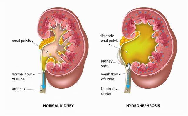 红细胞|肾功能下降，血压升高，血脂升高，肾脏疾病，应当提防