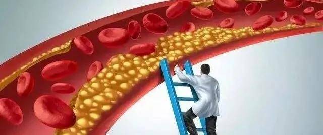 水平|4成血脂异常!!国人健康何以为继??