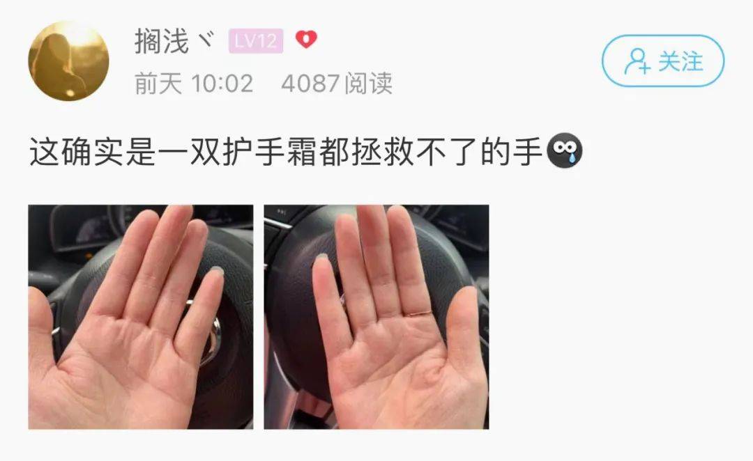 双手姑娘这双手，护手霜都拯救不了！网友：一看就知道是做什么的