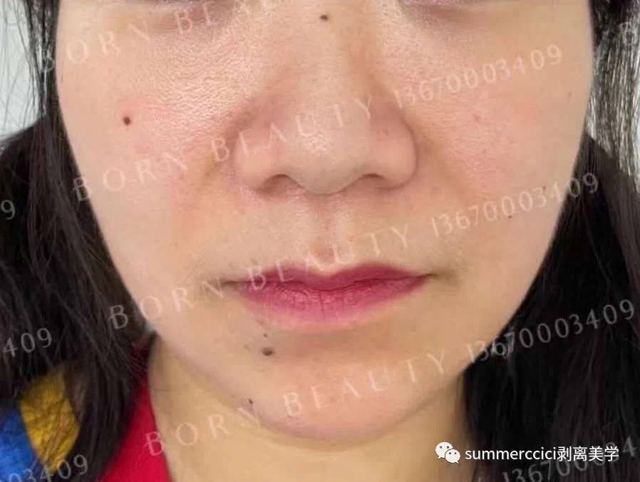 苹果逢亮相必热搜，唐嫣状态满分的秘密武器原来靠的是它！