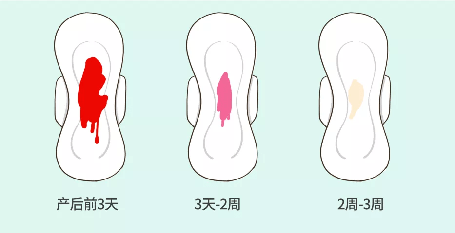 产后不正常颜色恶露图图片