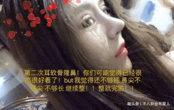 因为00后网红整容成瘾，13岁开整花费百万，整成惊悚脸想选秀出道