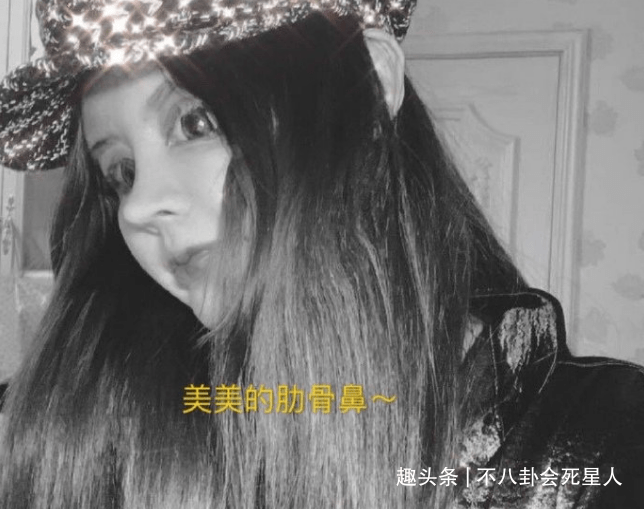 因为00后网红整容成瘾，13岁开整花费百万，整成惊悚脸想选秀出道