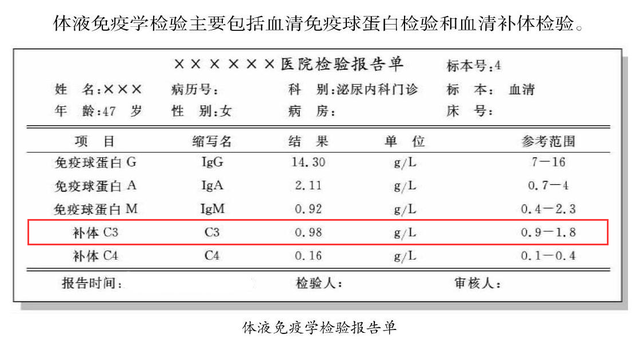 肾炎检查单图片