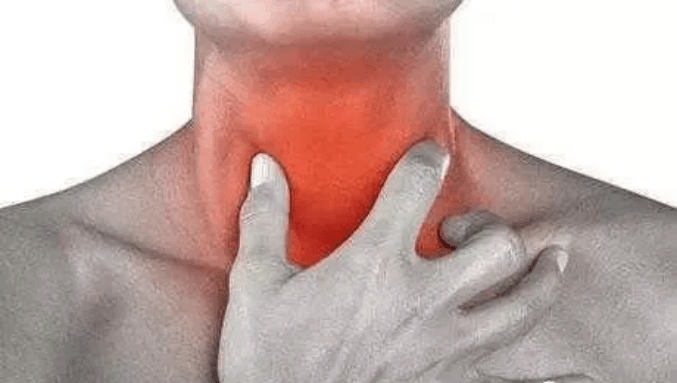 严重|卢老健康课堂:发现睁眼困难、眼睑下垂谨慎—眼肌型重症肌无力！