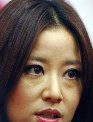 林心如的脸怎么老成这样了?_琼瑶