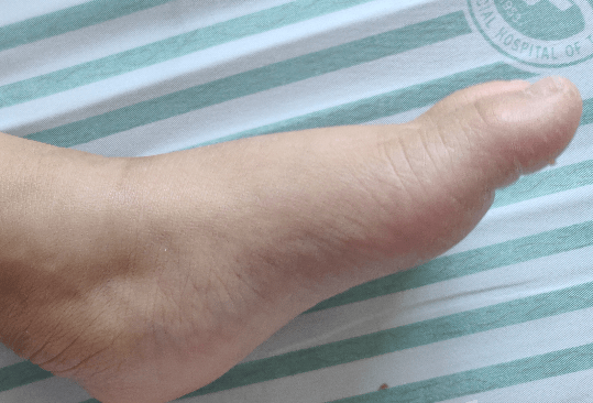 肝脏|肝脏向你求救会发出4大信号！坚持做好4个小习惯，还有的救