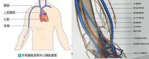 静脉|学党史 办实事 | 第三中心医院PICC换药门诊，解决患者后“护”之忧