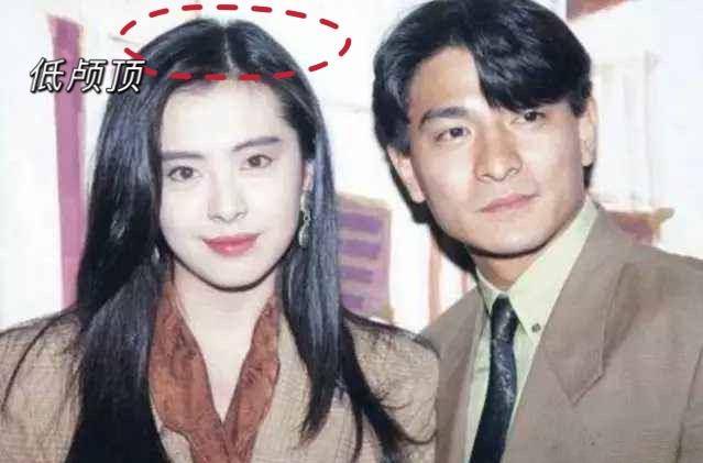 因为容貌焦虑到发疯，用水泥填颅顶！请停止颅顶焦虑