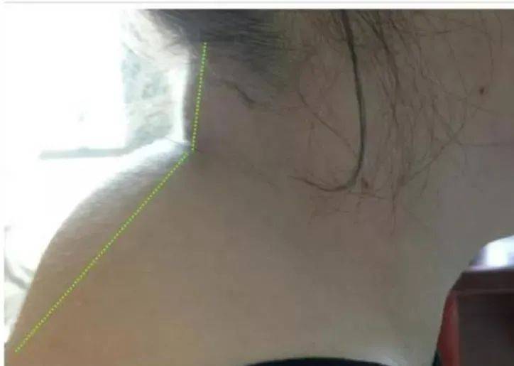 医学科|是病！得治！｜“富贵包”不富贵