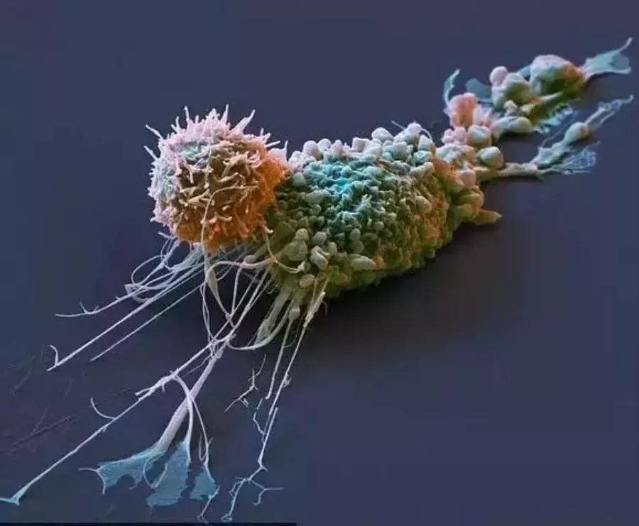 科普图片免疫细胞与癌细胞搏斗现场