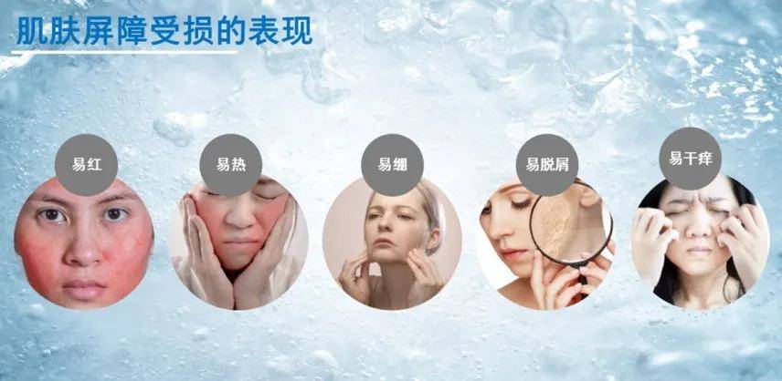 Susu不是吧！万能的早C晚A，居然有人用到烂脸？