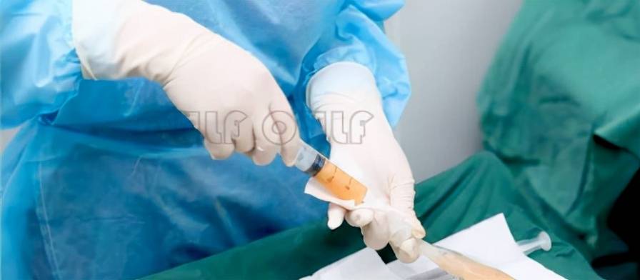 脸部全面还原:脸部脂肪填充恢复过程，全脸脂肪填充5到10天照片~