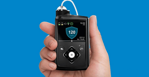 血糖|美敦力胰岛素泵：“人工胰腺”控糖黑科技，为糖友带来巨大的帮助