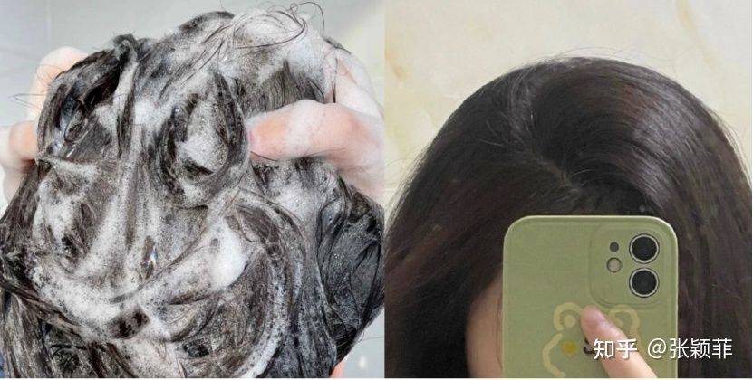 头皮洗发水越洗越秃？孕期别乱买网红洗发水，资源头皮痒，植观不回购