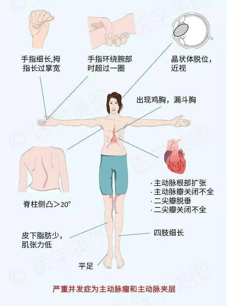一辈子戴项圈硬拽出全球第一天鹅颈好可怕的审美