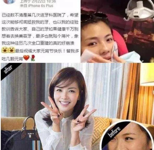 全口娱乐圈人人一口“大白牙”，大概早已忘记“笑不露齿”了吧