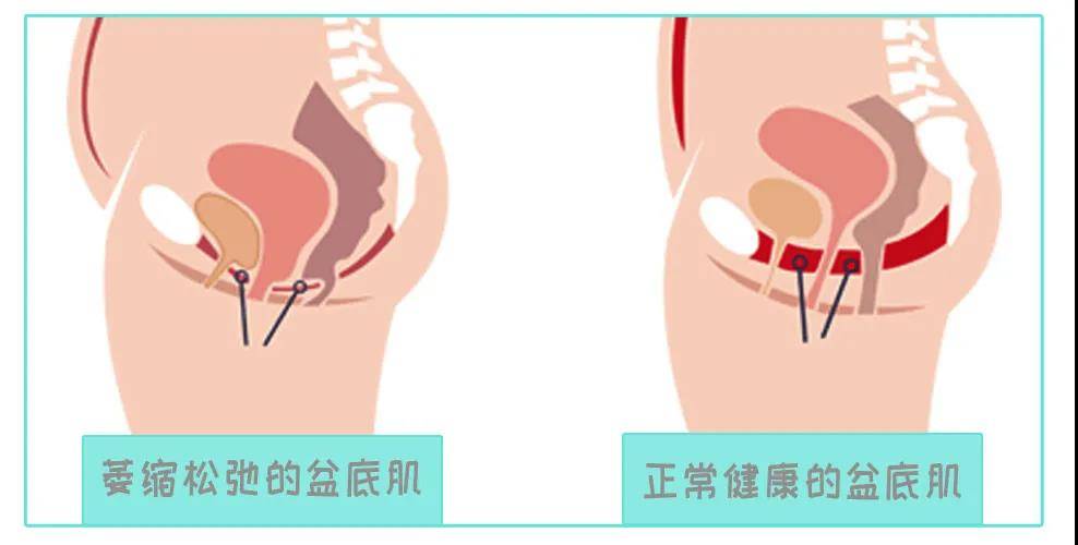 什么是松弛平滑肌 fab539ab504044fc90c8ff78c49a491b.jpeg