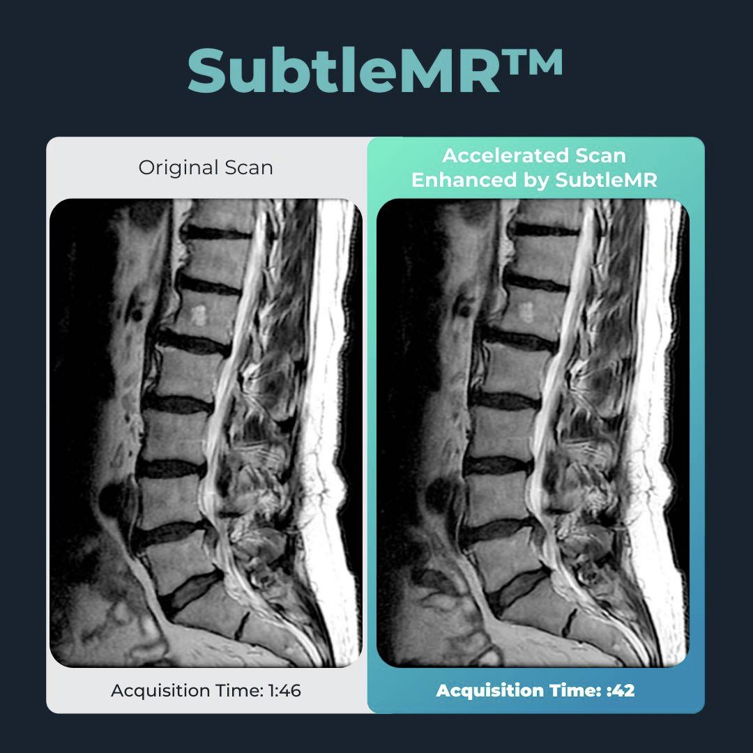 与拜耳、西门子合作，深透医疗落地AI医疗全新商业模式