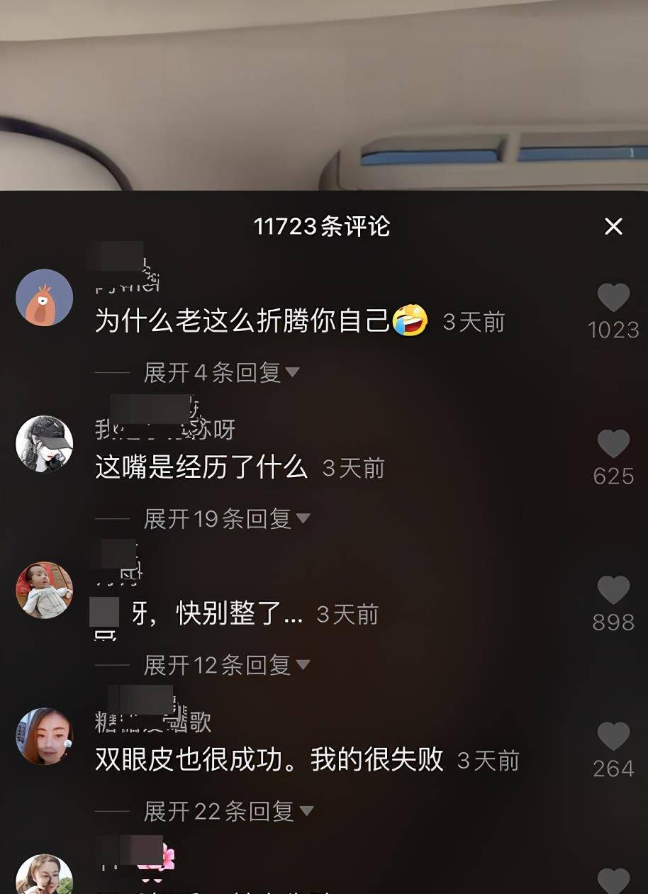 因为女网红沉迷整容却越整越难看，近照嘴巴肿成香肠嘴，承认整容失败