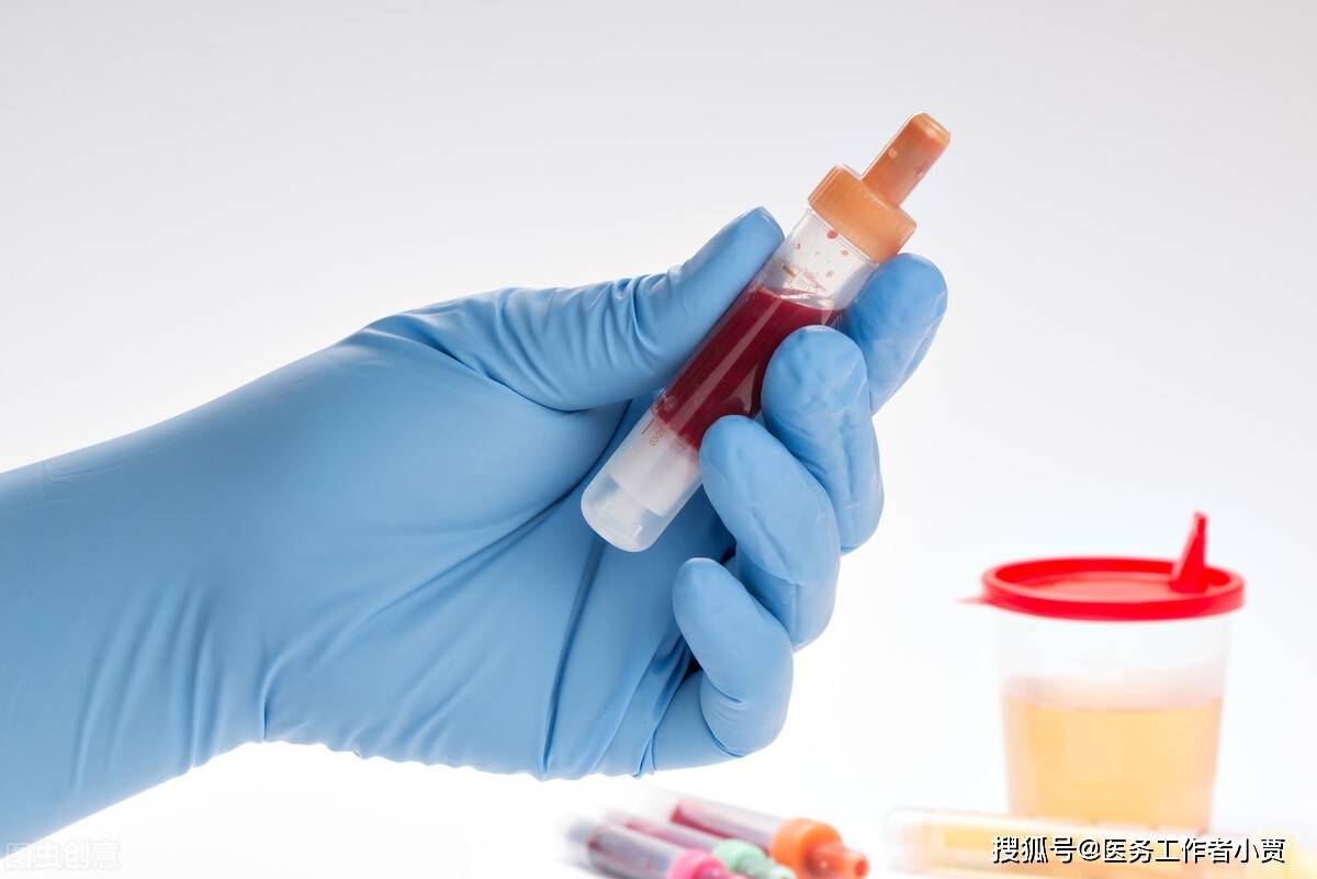 功能|「问答」尿常规检查注意事项、影响因素等，你知道吗？