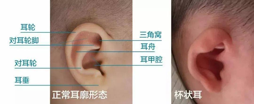 耳朵外形图图片