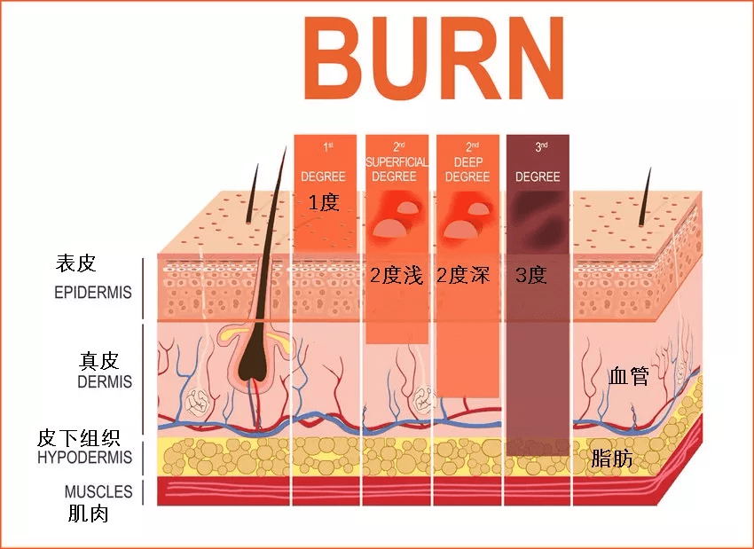 《天使儿童急救手册》孩子烧烫伤时,冲泡一定有好处吗?_处理_冷却_面