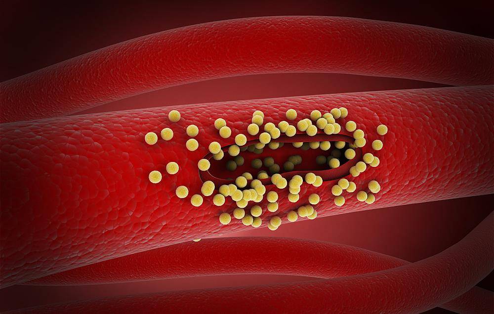 成宝|4种“假牛奶”已被列入黑名单,有些父母却当成宝,整箱往家搬