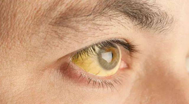 眼睛|肝脏的解毒功能会表现在脸上?你若没有4种情况,肝脏很健康