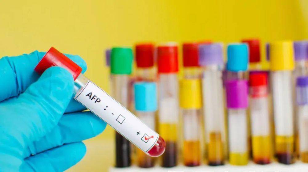 转氨酶|体检报告e抗原阳性，转氨酶正常，是乙肝病毒活跃吗？需要治疗吗