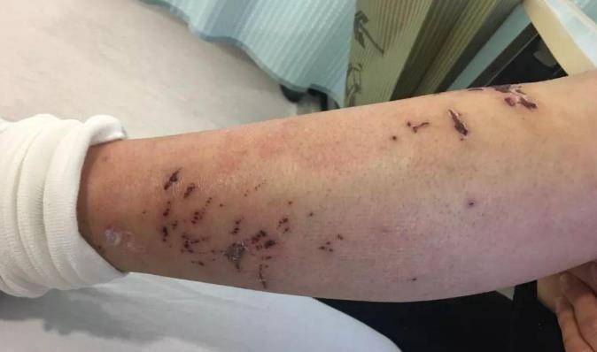 年代|25岁情侣双双查出糖尿病，医生：什么年代了，厨房这2物，赶紧扔