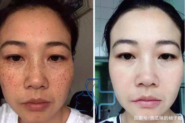 白得更美白淡斑护肤品哪款好？用这个精准亮白淡斑，美到发光！