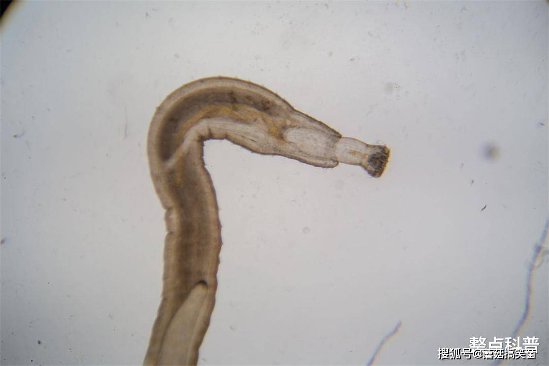 会继续吸血吗_胃部_胃酸_吸盘