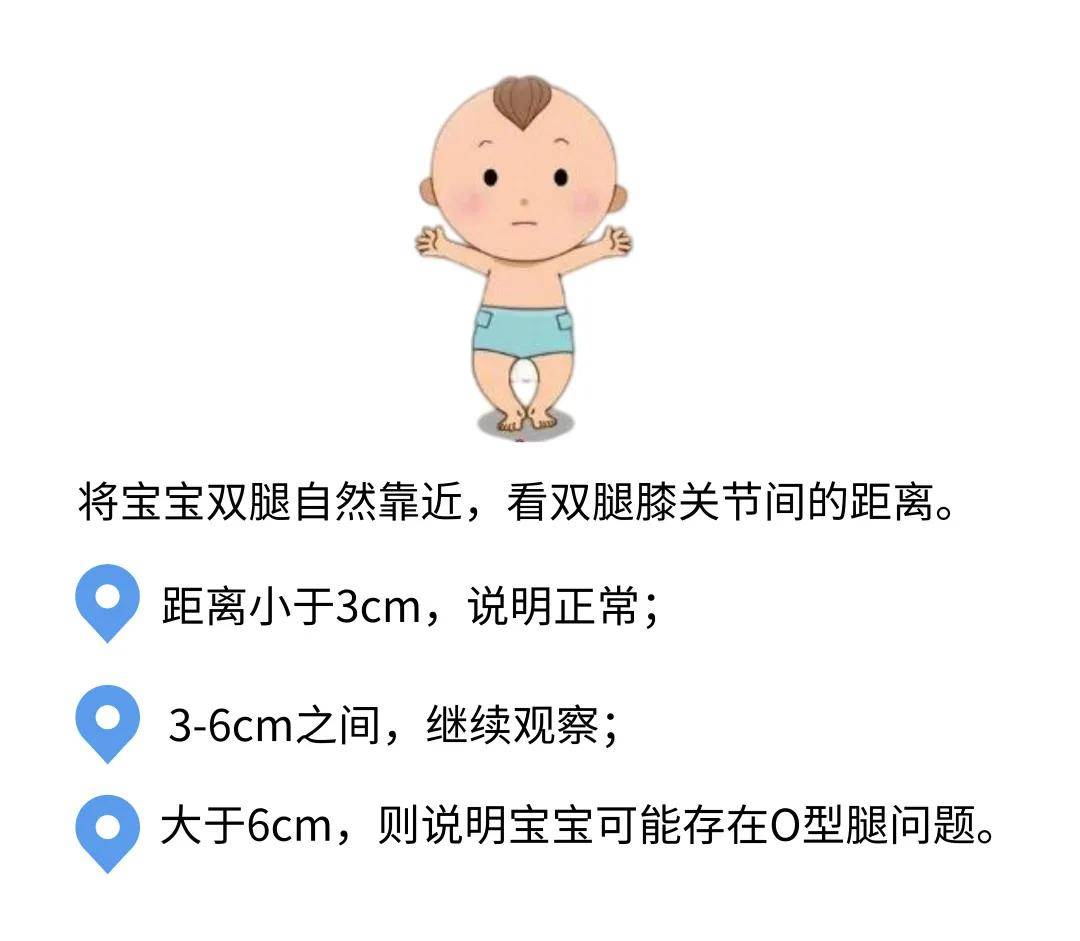宝宝腿不直就是o型腿?别让谣言忽悠了你!_扶站_绑腿_维生素