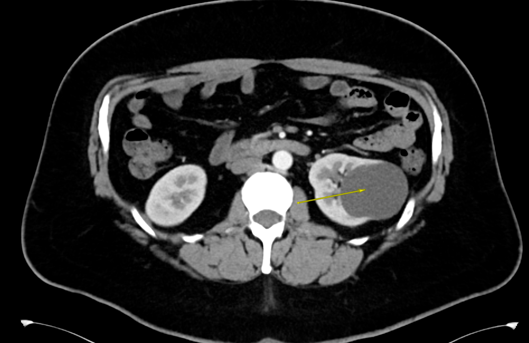治疗|点赞合肥京东方医院的医疗服务很有“国际范儿”!