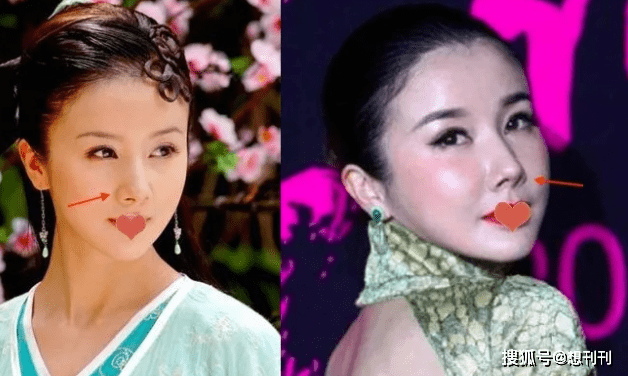 因为内娱“假鼻子”大PK,谁的假到逆天,谁的越整越残?