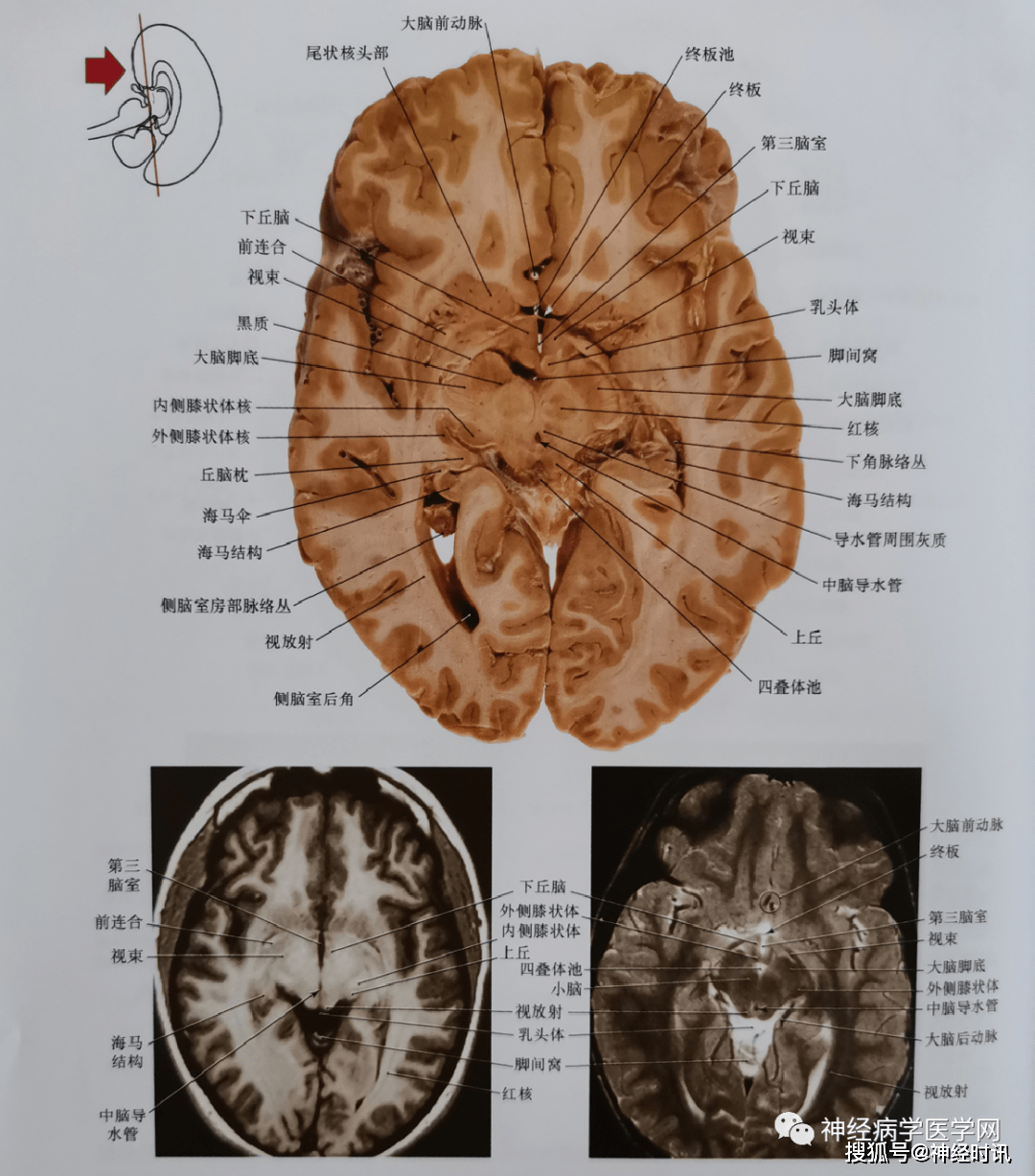 c72e54ca8c4a454abe97cc4a9172444f.png