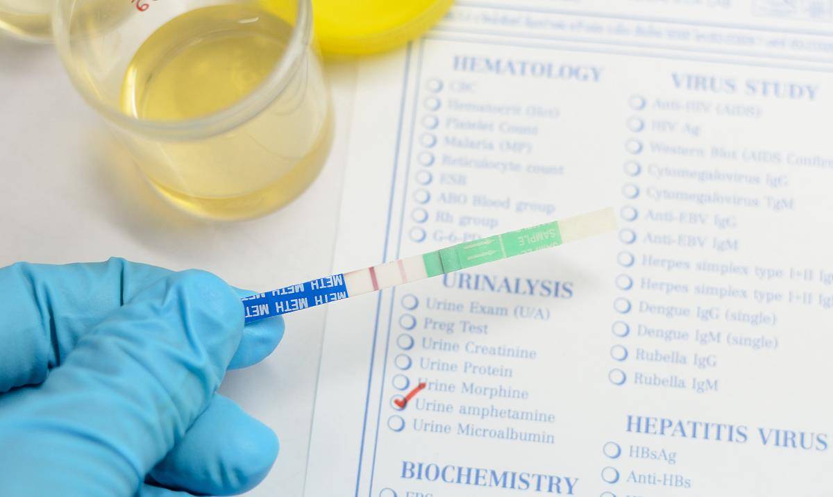 关键|不想肾病发展成肾衰竭,肾友要抓住5个关键时间点,减轻肾脏负担