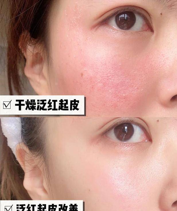 症状原来肌肤好的女生，都保持这样的习惯，难怪看起来水润细腻显气质