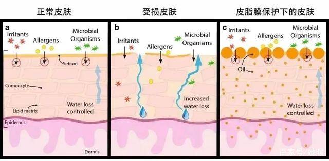 毛囊“换季就变丑”？容貌焦虑的我有多难，你知道吗~