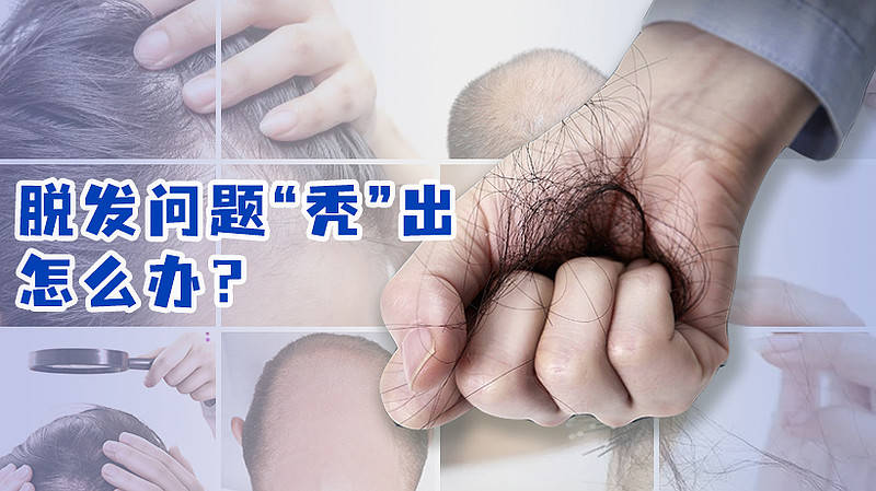 kDa|成都平安医院脱发问题“秃”出 这个年终惠民公益普查不能错过