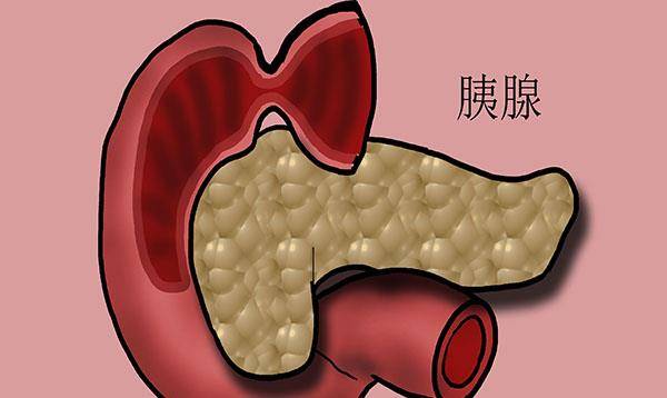 治疗|吃糖多才会得糖尿病？一文带您了解糖尿病的“前世今生”